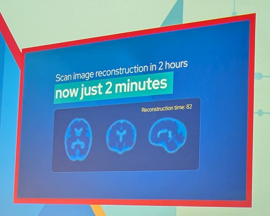 Keynote slide reading Scan image reconstruction in 2 hours, now just 2 minutes, above three brain scan reconstructions
